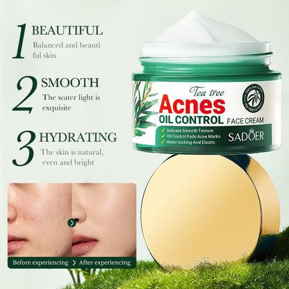 Crema Facial Control del Acné con Aceite de Árbol de Té 50ml SADOER